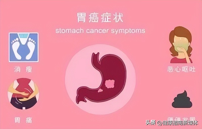 常见癌症有何早期征兆