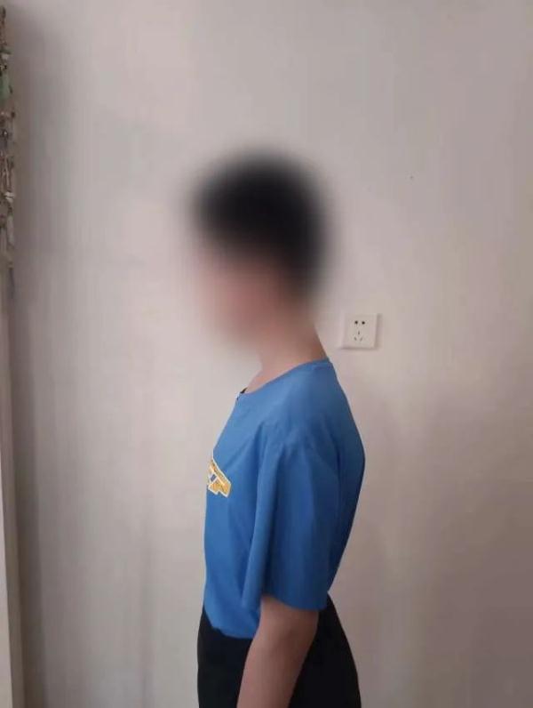 每天开塞露隔天要灌肠，巨结肠危象患儿在首儿所获新生