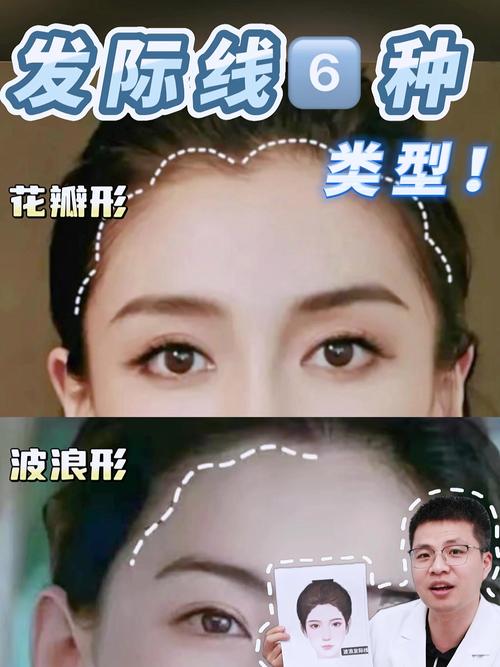 发际线美学丨什么样的发际线才是适合自己的？