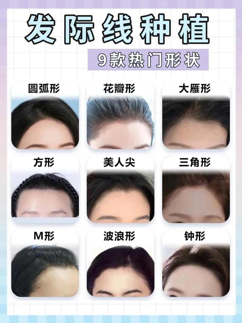 发际线美学丨什么样的发际线才是适合自己的？