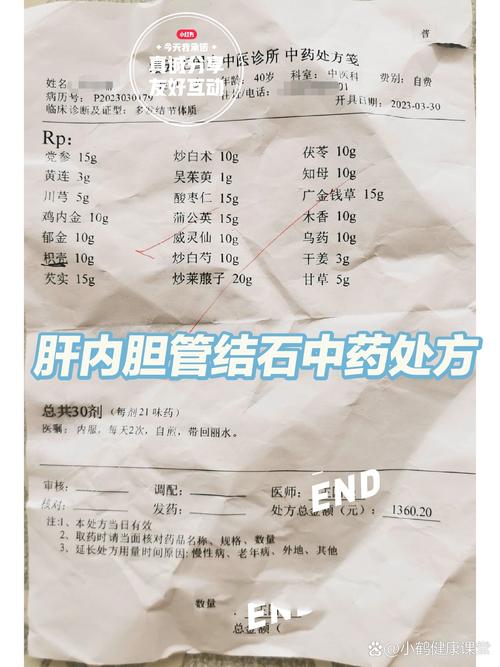 本人检查出右肝胆管有0.4结石，用7天排石法