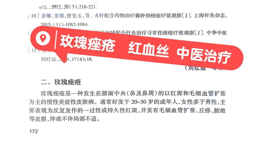 老中医压箱底的【玫瑰痤疮】方子，逼出身体湿热，玫瑰有效率99%