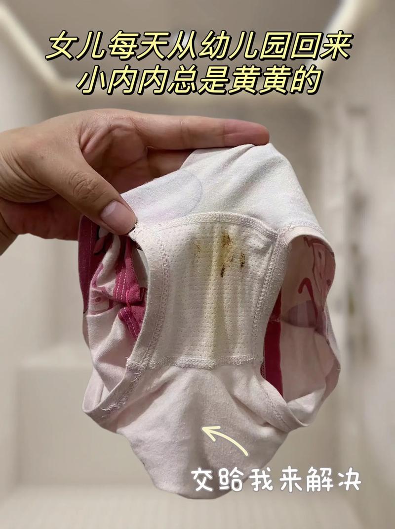 内裤出现3种颜色，当心癌盯上你！千万别以为只是有点脏
