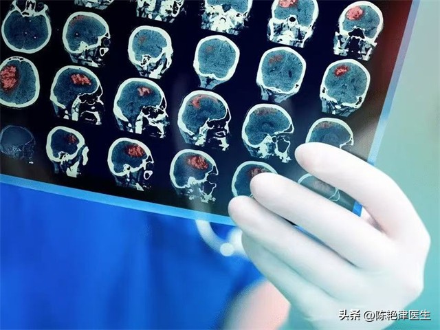 每吃一次，大脑萎缩就快一步？这5种食物是大脑老化的“加速器”