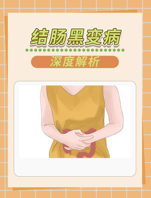 直肠黑变病的概述