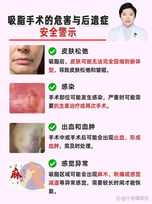 吸脂手术有什么危害