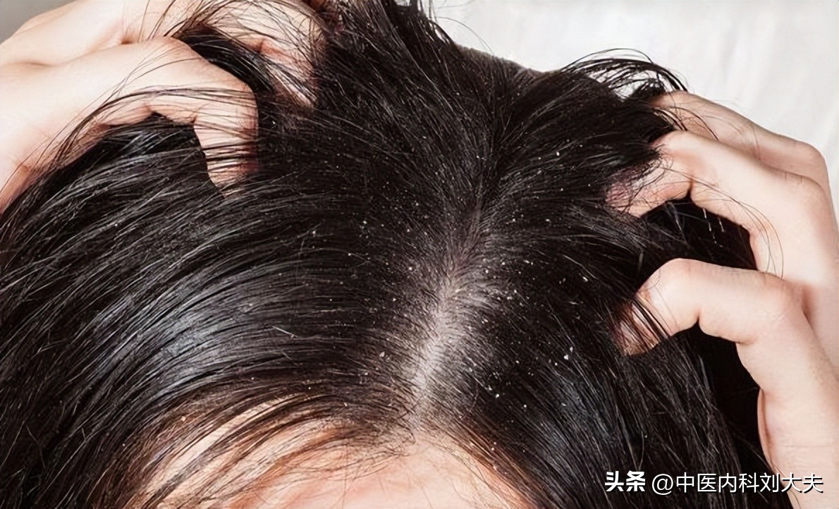 血热、头发干枯、长白发，分享一个中成药，滋补肝肾、凉血养发