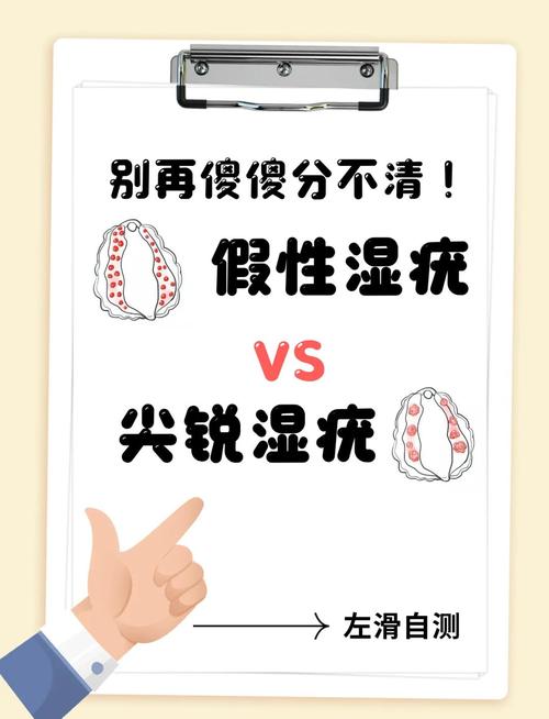 假性尖锐湿和真性的有什么明显区别