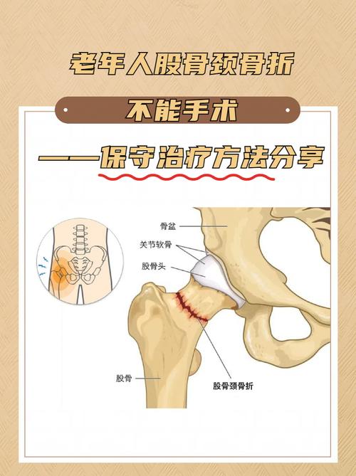 高龄股骨颈骨折关节置换手术风险大吗？该如何面对做出选择？