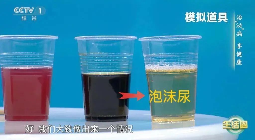 健康科普 | 喝水后4个异常，可能是肾发出的“求救信号”！