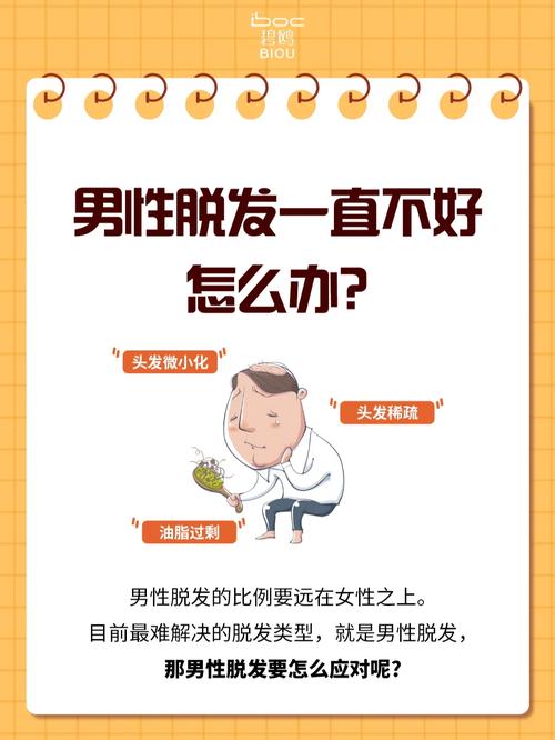 男性脱发治疗的最佳时机