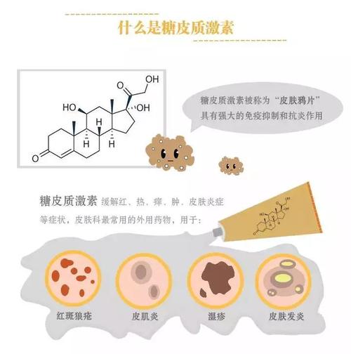 糖皮质激素