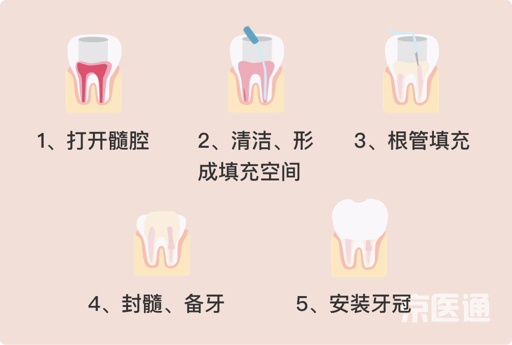 “牙痛神药”真的有用么？口腔医生说出了真相