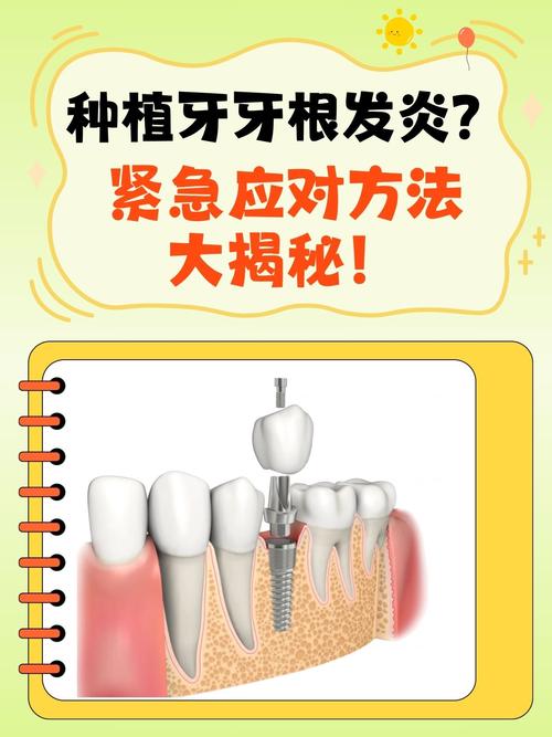 种植牙两年后发炎是什么症状？疼痛正常吗？告诉你疼痛发炎怎么办