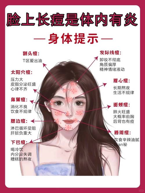 少女脸上长痘痘怎么办