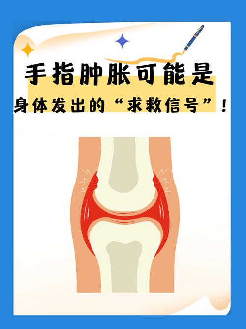 手肿胀是什么原因导致的？