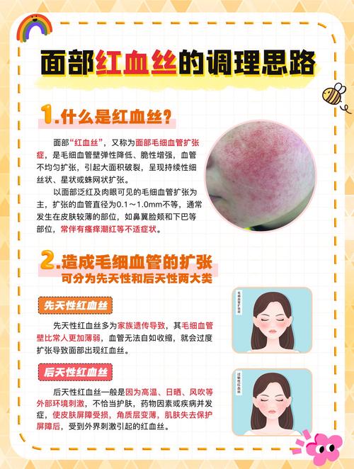 红血丝形成的原因 4招让面部红血丝彻底消除