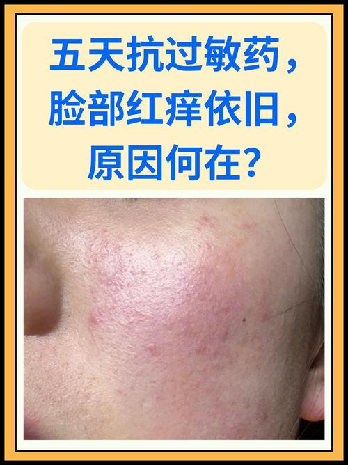 168种成分往脸上抹，你不怕过敏吗？