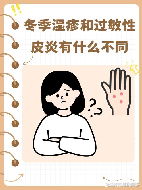 冬季要防三大皮肤过敏症