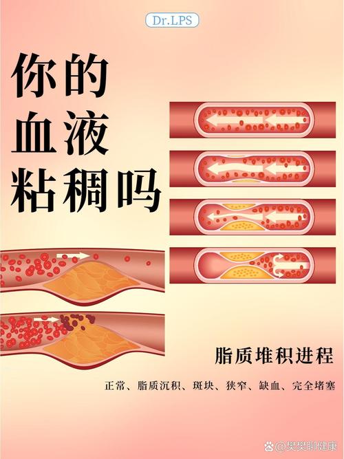 血粘稠怎么办