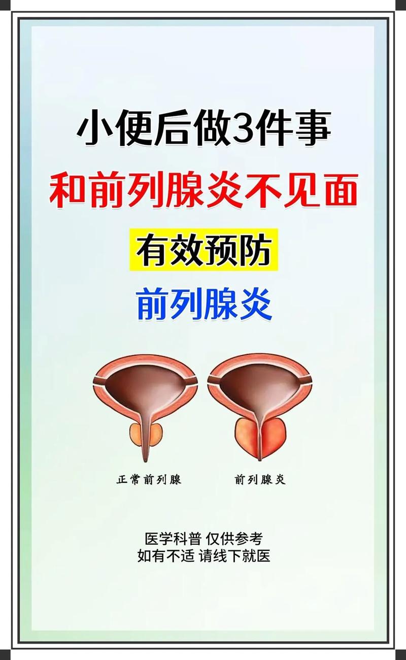 3大方法教你有效治疗前列腺炎