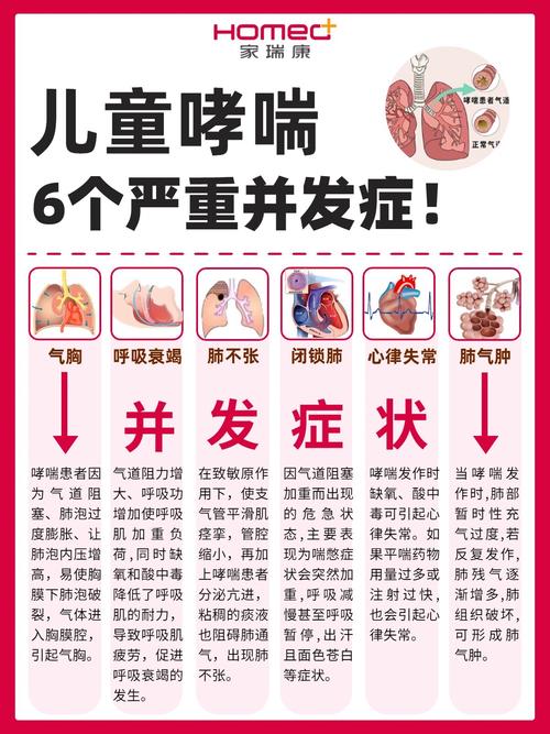 春季儿童哮喘高发 家长们还应注意什么？