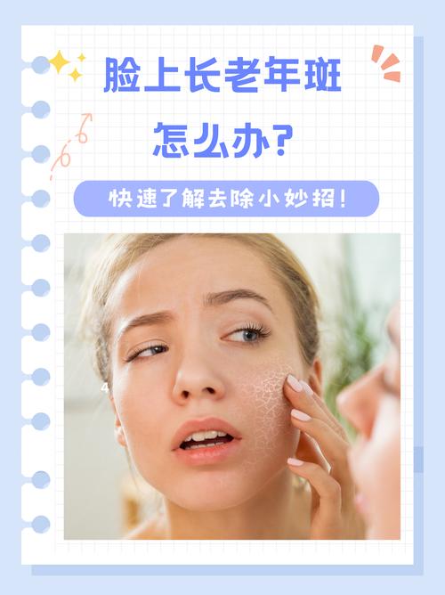 脸上长"小斑点"是怎么回事，可以用柠檬擦掉吗?如何调理?一文看懂