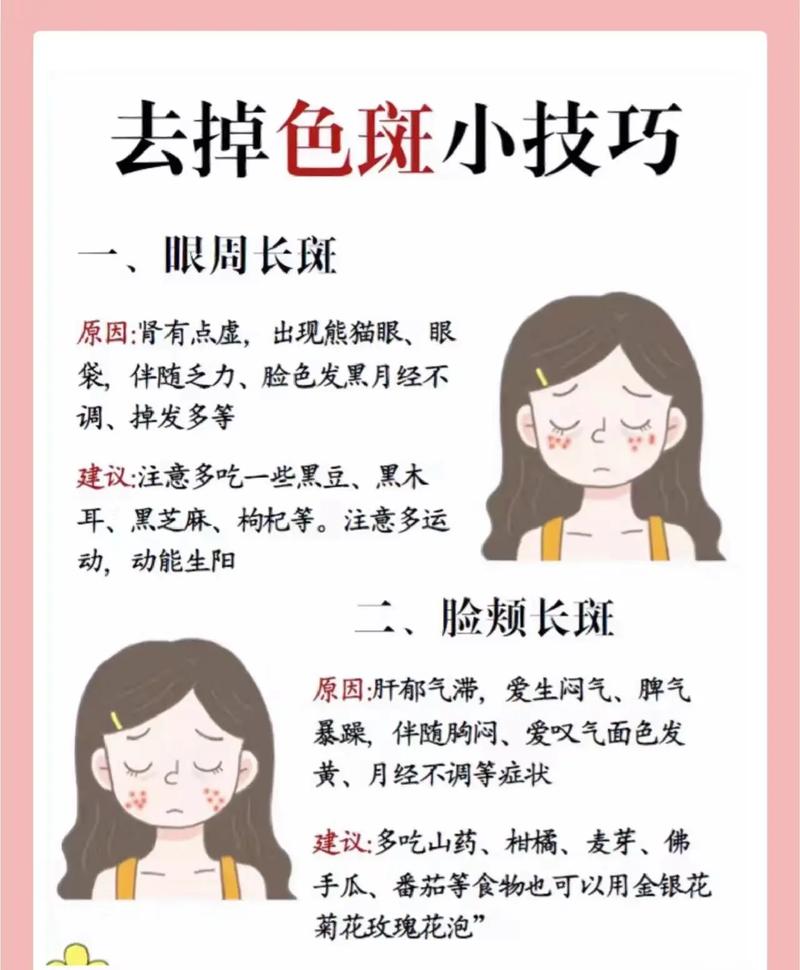 脸上如何祛斑？脸部祛斑方法值得一看