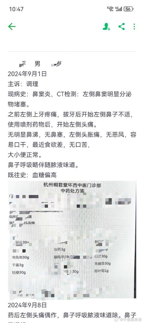瑞金病例丨头痛欲裂，竟然是鼻窦“发霉”