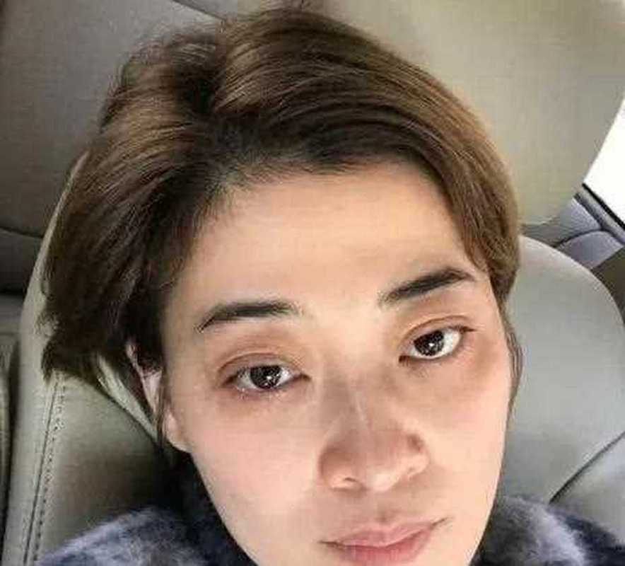 梅婷黑眼圈原因