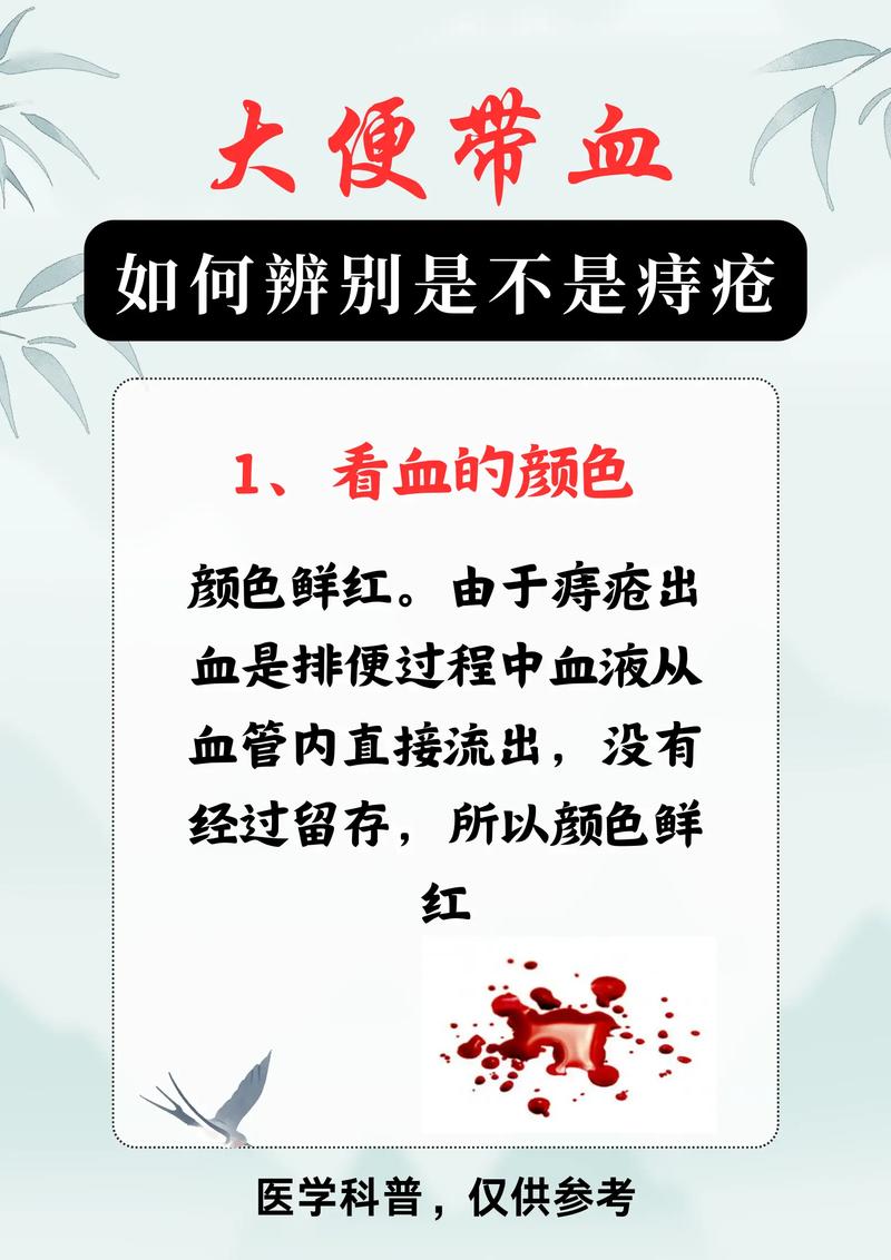 痔疮出血怎么办？
