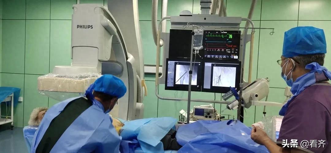 齐齐哈尔关注：再攻关！梅里斯首例股骨头缺血性坏死（Ⅲ期）介入灌注股骨头髓芯减压术成功
