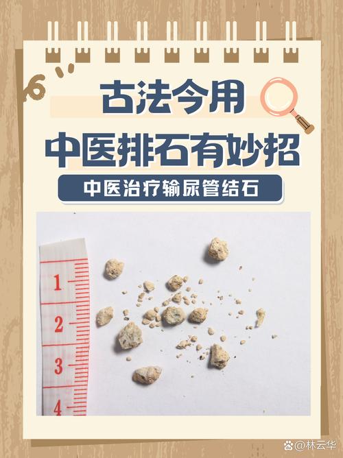 输尿管上段结石的治疗方法