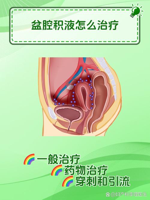 盆腔积液需要治疗吗
