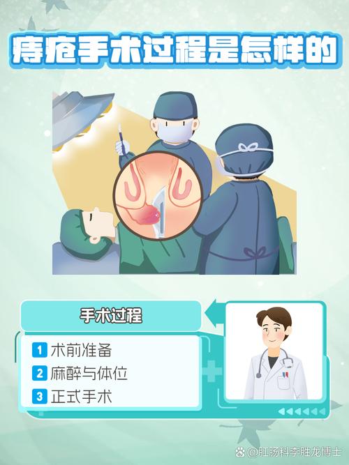 痔疮手术哪种最彻底？哪种最不疼？一文告诉你常见痔疮手术优缺点