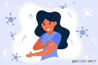 湿疹是什么原因造成的？司普奇拜单抗助力患者更好控制疾病