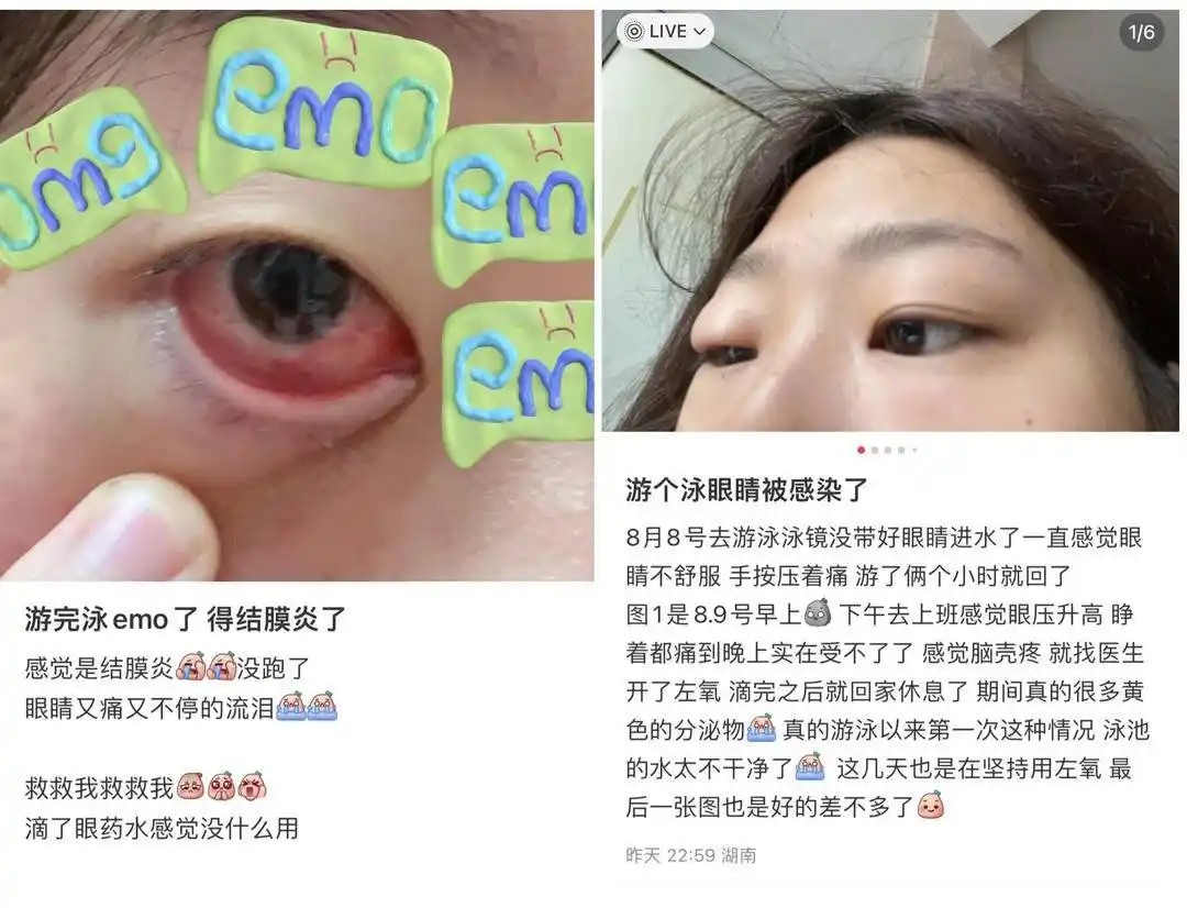 游泳戴护目镜会增加近视度数？预防眼睛发红，用生理盐水冲洗？｜网红说法求真