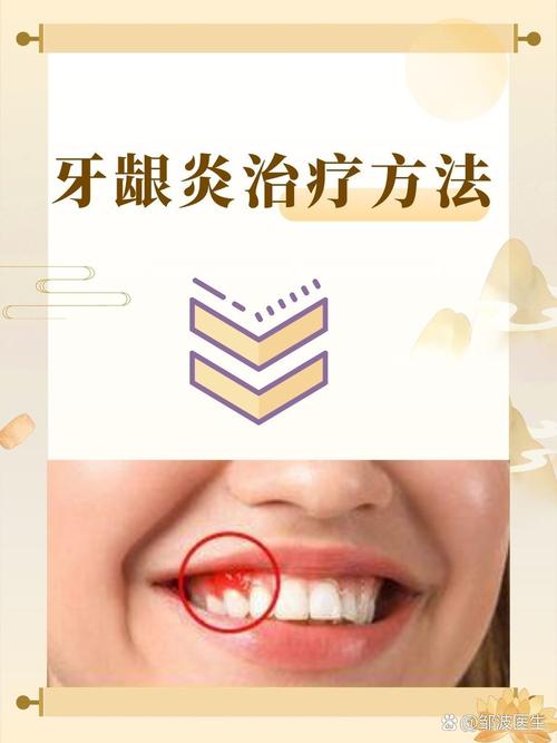 慢性牙龈炎怎样治疗