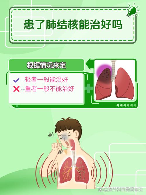 肺结核能根除吗