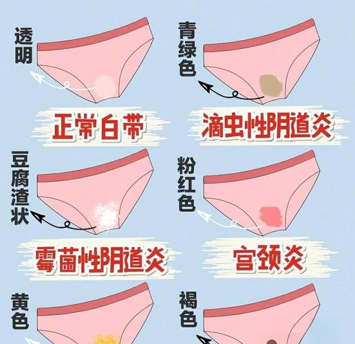 女性内裤出现3种颜色，当心妇科病盯上你！千万别以为只是有点脏