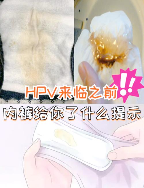 女性内裤出现3种颜色，当心妇科病盯上你！千万别以为只是有点脏