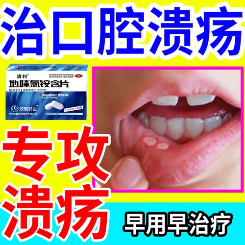 得了口腔溃疡吃什么药呢