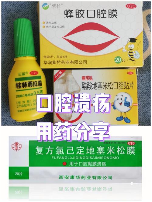 得了口腔溃疡吃什么药呢