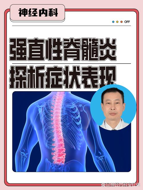 脊髓炎有什么症状？怀疑脊髓炎做什么检查？