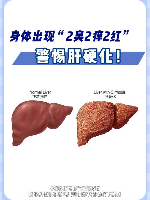 肝功能不健康的人，或会出现“2痒、3黑”，若你有，或需检查