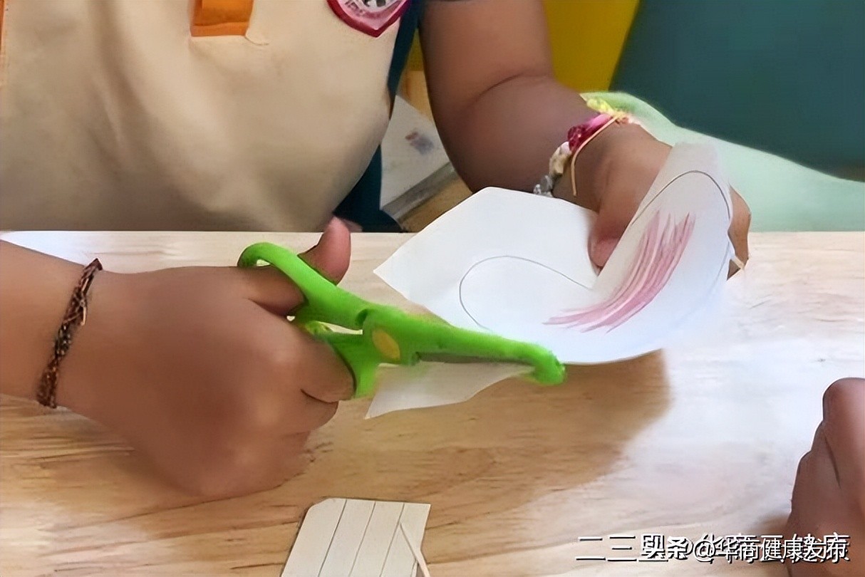 6岁女孩患多巴反应性肌张力障碍手指难抓握 作业治疗3个月为手功能赋能