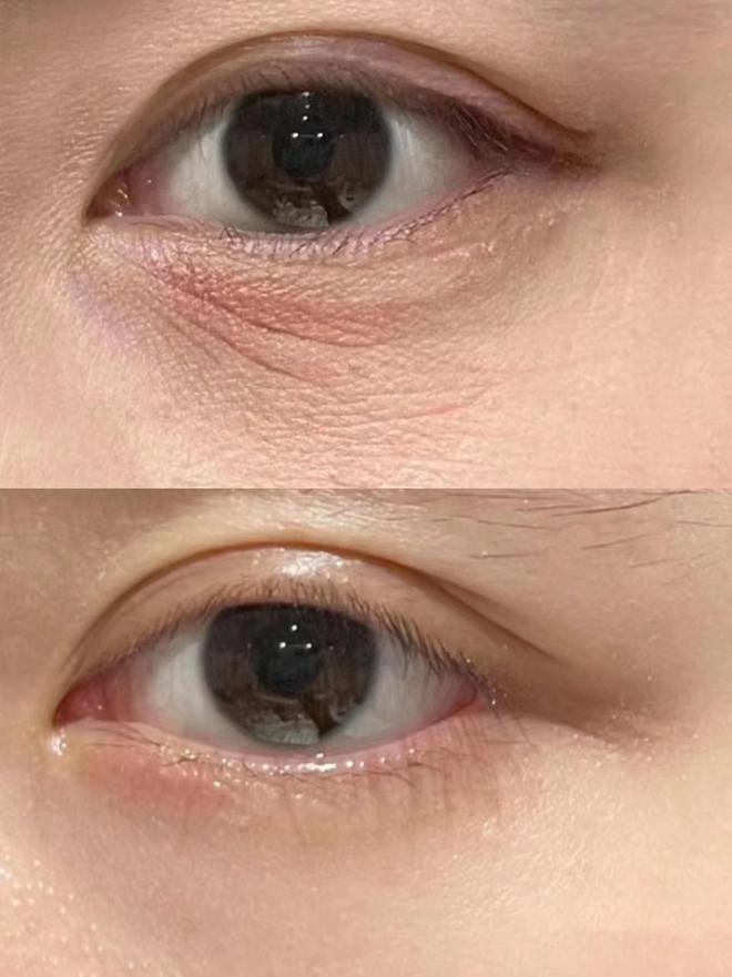 25岁男士眼霜去眼袋哪个牌子好？只说真话，选对眼霜不花冤枉钱