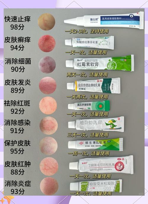 怎么治疗接触性皮炎好