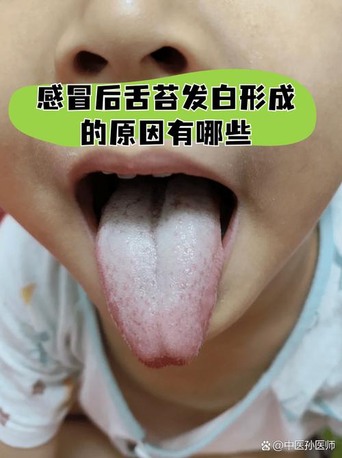 感冒舌苔发白是什么原因