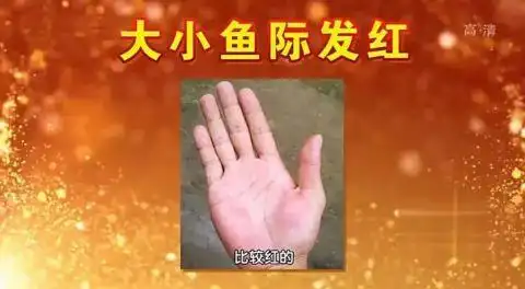肝脏好不好，看手就知道！一个信号，是肝脏在求救！